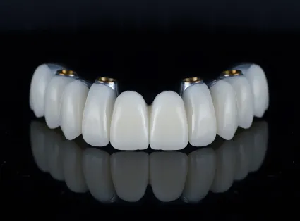 Dental Implants at Copper Hills Dental