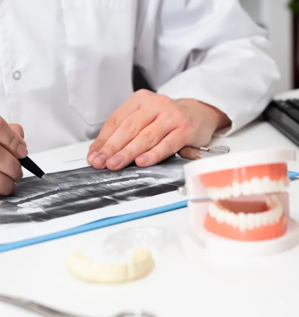 Apicoectomy at Copper Hills Dental