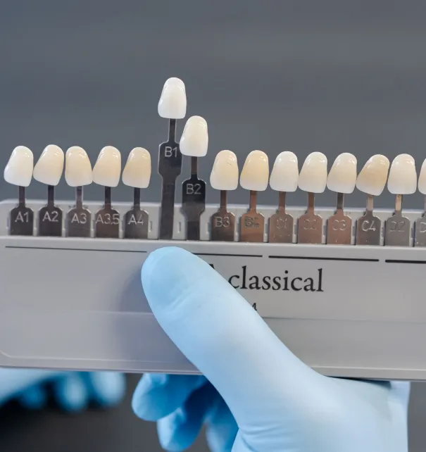 Dental Veneers at Copper Hills Dental