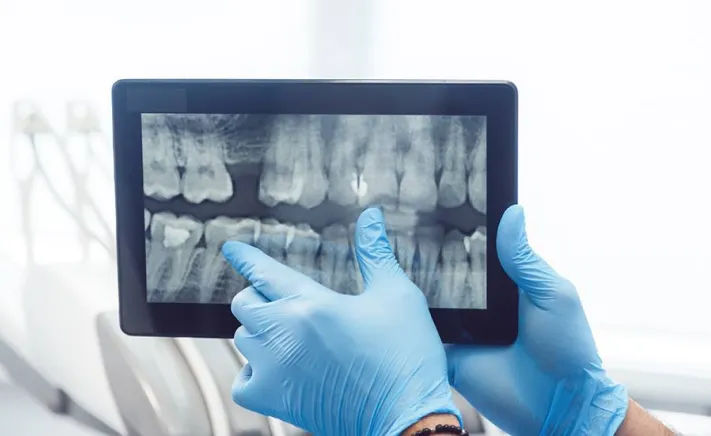 Digital X-Rays at Copper Hills Dental