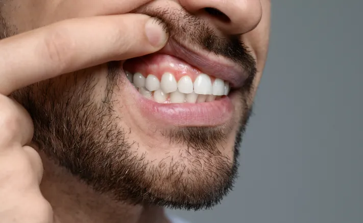 Gum Disease Treatment at Copper Hills Dental