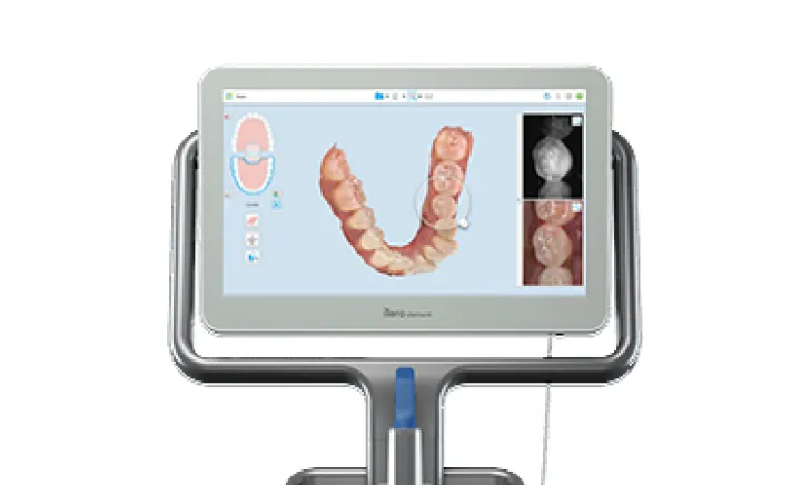 iTero® Digital Scanning at Copper Hills Dental