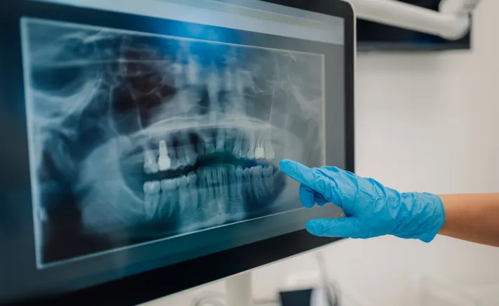 Panoramic X-Rays at Copper Hills Dental