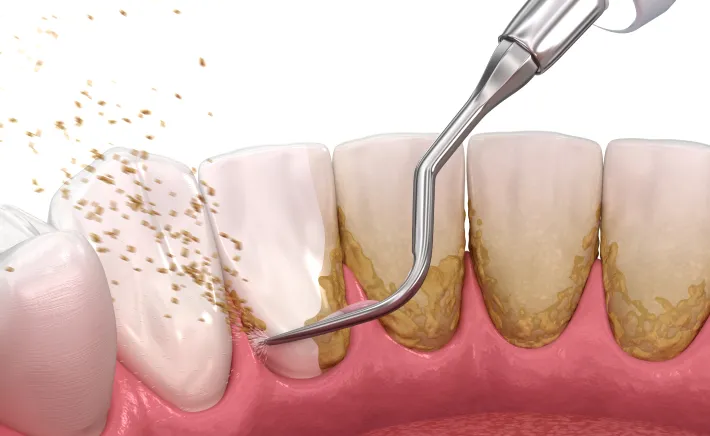 General Dentistry at Copper Hills Dental